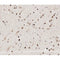 AF0268 at 1/100 staining human brain tissue sections by IHC-P. The tissue was formaldehyde fixed and a heat mediated antigen retrieval step in citrate buffer was performed. The tissue was then blocked and incubated with the antibody for 1.5 hours at 22¡ãC. An HRP conjugated goat anti-rabbit antibody was used as the secondary
