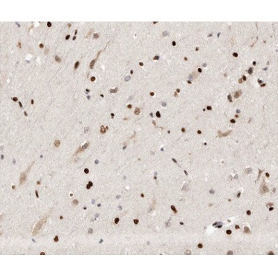 AF0268 at 1/100 staining human brain tissue sections by IHC-P. The tissue was formaldehyde fixed and a heat mediated antigen retrieval step in citrate buffer was performed. The tissue was then blocked and incubated with the antibody for 1.5 hours at 22¡ãC. An HRP conjugated goat anti-rabbit antibody was used as the secondary