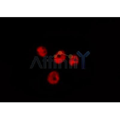 AF0268 staining A549 by IF/ICC. The sample were fixed with PFA and permeabilized in 0.1% Triton X-100,then blocked in 10% serum for 45 minutes at 25¡ãC. The primary antibody was diluted at 1/200 and incubated with the sample for 1 hour at 37¡ãC. An  Alexa Fluor 594 conjugated goat anti-rabbit IgG (H+L) Ab, diluted at 1/600, was used as the secondary antibod