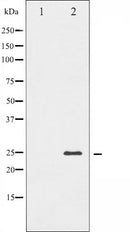 AF6215 at 1/100 staining Human prostate tissue by IHC-P. The sample was formaldehyde fixed and a heat mediated antigen retrieval step in citrate buffer was performed. The sample was then blocked and incubated with the antibody for 1.5 hours at 22¡ãC. An HRP conjugated goat anti-rabbit antibody was used as the secondary
