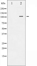 AF6217 at 1/100 staining Rat kidney tissue by IHC-P. The sample was formaldehyde fixed and a heat mediated antigen retrieval step in citrate buffer was performed. The sample was then blocked and incubated with the antibody for 1.5 hours at 22¡ãC. An HRP conjugated goat anti-rabbit antibody was used as the secondary