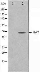 Western blot analysis on LOVO cell lysate using HAT Antibody,The lane on the left is treated with the antigen-specific peptide.