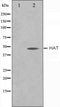 Western blot analysis on LOVO cell lysate using HAT Antibody,The lane on the left is treated with the antigen-specific peptide.