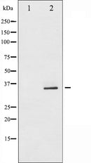 AF6237 staining Hela by IF/ICC. The sample were fixed with PFA and permeabilized in 0.1% Triton X-100,then blocked in 10% serum for 45 minutes at 25¡ãC. The primary antibody was diluted at 1/200 and incubated with the sample for 1 hour at 37¡ãC. An  Alexa Fluor 594 conjugated goat anti-rabbit IgG (H+L) Ab, diluted at 1/600, was used as the secondary antibod