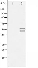 AF6246 at 1/100 staining Mouse testis tissue by IHC-P. The sample was formaldehyde fixed and a heat mediated antigen retrieval step in citrate buffer was performed. The sample was then blocked and incubated with the antibody for 1.5 hours at 22¡ãC. An HRP conjugated goat anti-rabbit antibody was used as the secondary