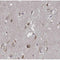 AF0274 at 1/100 staining human brain tissue sections by IHC-P. The tissue was formaldehyde fixed and a heat mediated antigen retrieval step in citrate buffer was performed. The tissue was then blocked and incubated with the antibody for 1.5 hours at 22¡ãC. An HRP conjugated goat anti-rabbit antibody was used as the secondary