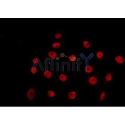 AF0274 staining 293 by IF/ICC. The sample were fixed with PFA and permeabilized in 0.1% Triton X-100,then blocked in 10% serum for 45 minutes at 25¡ãC. The primary antibody was diluted at 1/200 and incubated with the sample for 1 hour at 37¡ãC. An  Alexa Fluor 594 conjugated goat anti-rabbit IgG (H+L) Ab, diluted at 1/600, was used as the secondary antibod