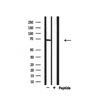 Western blot analysis of extracts from mouse heart, using PIAS3 Antibody.