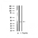 AF6250 staining A549 cells by IF/ICC. The sample were fixed with PFA and permeabilized in 0.1% Triton X-100,then blocked in 10% serum for 45 minutes at 25¡ãC. The primary antibody was diluted at 1/200 and incubated with the sample for 1 hour at 37¡ãC. An  Alexa Fluor 594 conjugated goat anti-rabbit IgG (H+L) antibody(Cat.