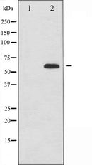 AF6257 at 1/100 staining Human prostate tissue by IHC-P. The sample was formaldehyde fixed and a heat mediated antigen retrieval step in citrate buffer was performed. The sample was then blocked and incubated with the antibody for 1.5 hours at 22¡ãC. An HRP conjugated goat anti-rabbit antibody was used as the secondary