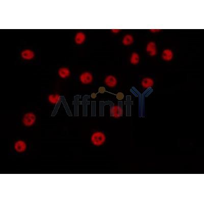 AF0275 staining Hela by IF/ICC. The sample were fixed with PFA and permeabilized in 0.1% Triton X-100,then blocked in 10% serum for 45 minutes at 25¡ãC. The primary antibody was diluted at 1/200 and incubated with the sample for 1 hour at 37¡ãC. An  Alexa Fluor 594 conjugated goat anti-rabbit IgG (H+L) Ab, diluted at 1/600, was used as the secondary antibod