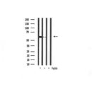 Western blot analysis of extracts from B16F10, using Akt2 Antibody. The lane on the left was treated with blocking peptide.