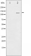 AF6265 at 1/100 staining Human liver cancer tissue by IHC-P. The sample was formaldehyde fixed and a heat mediated antigen retrieval step in citrate buffer was performed. The sample was then blocked and incubated with the antibody for 1.5 hours at 22¡ãC. An HRP conjugated goat anti-rabbit antibody was used as the secondary
