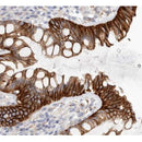 AF6266 staining SW626 by IF/ICC. The sample were fixed with PFA and permeabilized in 0.1% Triton X-100,then blocked in 10% serum for 45 minutes at 25¡ãC. The primary antibody was diluted at 1/200 and incubated with the sample for 1 hour at 37¡ãC. An  Alexa Fluor 594 conjugated goat anti-rabbit IgG (H+L) Ab, diluted at 1/600, was used as the secondary antibod