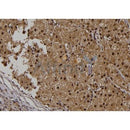 Western blot analysis of extracts from 3t3, using iNOS Antibody. The lane on the left was treated with blocking peptide.