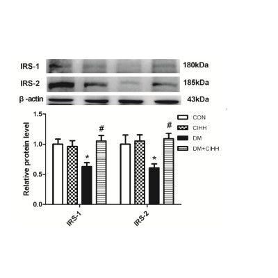 AF6273 at 1/100 staining Mouse lung tissue by IHC-P. The sample was formaldehyde fixed and a heat mediated antigen retrieval step in citrate buffer was performed. The sample was then blocked and incubated with the antibody for 1.5 hours at 22¡ãC. An HRP conjugated goat anti-rabbit antibody was used as the secondary