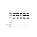 AF6277 at 1/100 staining Human gastric tissue by IHC-P. The sample was formaldehyde fixed and a heat mediated antigen retrieval step in citrate buffer was performed. The sample was then blocked and incubated with the antibody for 1.5 hours at 22¡ãC. An HRP conjugated goat anti-rabbit antibody was used as the secondary