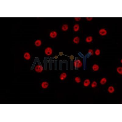 AF0276 staining COS7 by IF/ICC. The sample were fixed with PFA and permeabilized in 0.1% Triton X-100,then blocked in 10% serum for 45 minutes at 25¡ãC. The primary antibody was diluted at 1/200 and incubated with the sample for 1 hour at 37¡ãC. An  Alexa Fluor 594 conjugated goat anti-rabbit IgG (H+L) Ab, diluted at 1/600, was used as the secondary antibod
