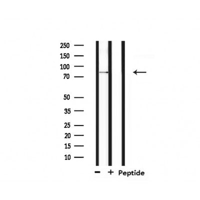 Western blot analysis of extracts from 293, using SENP5 Antibody.