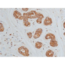 AF6281 staining K562 by IF/ICC. The sample were fixed with PFA and permeabilized in 0.1% Triton X-100,then blocked in 10% serum for 45 minutes at 25¡ãC. The primary antibody was diluted at 1/200 and incubated with the sample for 1 hour at 37¡ãC. An  Alexa Fluor 594 conjugated goat anti-rabbit IgG (H+L) Ab, diluted at 1/600, was used as the secondary antibod