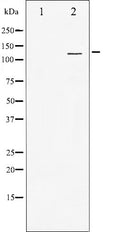 AF6283 at 1/100 staining Mouse lung tissue by IHC-P. The sample was formaldehyde fixed and a heat mediated antigen retrieval step in citrate buffer was performed. The sample was then blocked and incubated with the antibody for 1.5 hours at 22¡ãC. An HRP conjugated goat anti-rabbit antibody was used as the secondary
