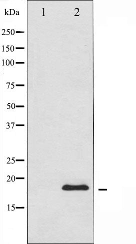 AF6285 at 1/100 staining Mouse liver tissue by IHC-P. The sample was formaldehyde fixed and a heat mediated antigen retrieval step in citrate buffer was performed. The sample was then blocked and incubated with the antibody for 1.5 hours at 22¡ãC. An HRP conjugated goat anti-rabbit antibody was used as the secondary