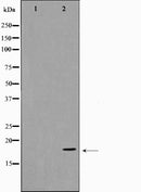 Western blot analysis of Synuclein-alpha expression in Etoposide treated 293 whole cell lysates,The lane on the left is treated with the antigen-specific peptide.