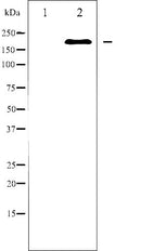 AF6289 at 1/100 staining Human breast cancer tissue by IHC-P. The sample was formaldehyde fixed and a heat mediated antigen retrieval step in citrate buffer was performed. The sample was then blocked and incubated with the antibody for 1.5 hours at 22¡ãC. An HRP conjugated goat anti-rabbit antibody was used as the secondary