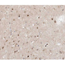 AF0278 at 1/100 staining human brain tissue sections by IHC-P. The tissue was formaldehyde fixed and a heat mediated antigen retrieval step in citrate buffer was performed. The tissue was then blocked and incubated with the antibody for 1.5 hours at 22¡ãC. An HRP conjugated goat anti-rabbit antibody was used as the secondary