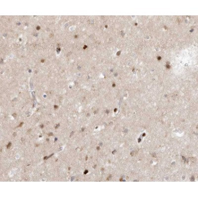 AF0278 at 1/100 staining human brain tissue sections by IHC-P. The tissue was formaldehyde fixed and a heat mediated antigen retrieval step in citrate buffer was performed. The tissue was then blocked and incubated with the antibody for 1.5 hours at 22¡ãC. An HRP conjugated goat anti-rabbit antibody was used as the secondary
