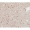 AF0278 at 1/100 staining human brain tissue sections by IHC-P. The tissue was formaldehyde fixed and a heat mediated antigen retrieval step in citrate buffer was performed. The tissue was then blocked and incubated with the antibody for 1.5 hours at 22¡ãC. An HRP conjugated goat anti-rabbit antibody was used as the secondary