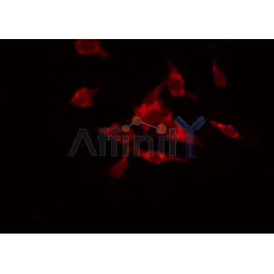 AF0278 staining HuvEc by IF/ICC. The sample were fixed with PFA and permeabilized in 0.1% Triton X-100,then blocked in 10% serum for 45 minutes at 25¡ãC. The primary antibody was diluted at 1/200 and incubated with the sample for 1 hour at 37¡ãC. An  Alexa Fluor 594 conjugated goat anti-rabbit IgG (H+L) Ab, diluted at 1/600, was used as the secondary antibod