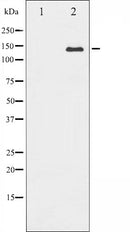 AF6296 at 1/100 staining Human lung tissue by IHC-P. The sample was formaldehyde fixed and a heat mediated antigen retrieval step in citrate buffer was performed. The sample was then blocked and incubated with the antibody for 1.5 hours at 22¡ãC. An HRP conjugated goat anti-rabbit antibody was used as the secondary