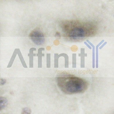 AF6298 at 1/100 staining Mouse testis tissue by IHC-P. The sample was formaldehyde fixed and a heat mediated antigen retrieval step in citrate buffer was performed. The sample was then blocked and incubated with the antibody for 1.5 hours at 22¡ãC. An HRP conjugated goat anti-rabbit antibody was used as the secondary