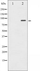 AF6301 at 1/100 staining Human breast cancer tissue by IHC-P. The sample was formaldehyde fixed and a heat mediated antigen retrieval step in citrate buffer was performed. The sample was then blocked and incubated with the antibody for 1.5 hours at 22¡ãC. An HRP conjugated goat anti-rabbit antibody was used as the secondary