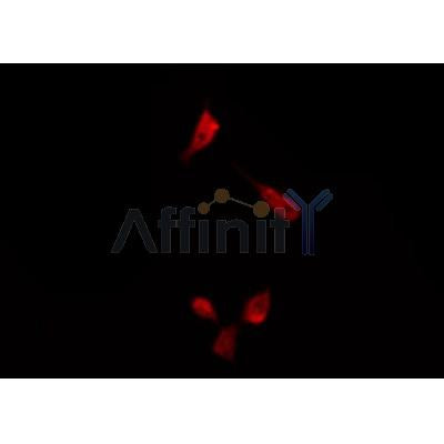 AF0096 staining K562 by IF/ICC. The sample were fixed with PFA and permeabilized in 0.1% Triton X-100,then blocked in 10% serum for 45 minutes at 25¡ãC. The primary antibody was diluted at 1/200 and incubated with the sample for 1 hour at 37¡ãC. An  Alexa Fluor 594 conjugated goat anti-rabbit IgG (H+L) Ab, diluted at 1/600, was used as the secondary antibod