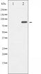 AF6307 at 1/100 staining Mouse muscle tissue by IHC-P. The sample was formaldehyde fixed and a heat mediated antigen retrieval step in citrate buffer was performed. The sample was then blocked and incubated with the antibody for 1.5 hours at 22¡ãC. An HRP conjugated goat anti-rabbit antibody was used as the secondary
