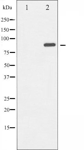 AF6307 at 1/100 staining Mouse muscle tissue by IHC-P. The sample was formaldehyde fixed and a heat mediated antigen retrieval step in citrate buffer was performed. The sample was then blocked and incubated with the antibody for 1.5 hours at 22¡ãC. An HRP conjugated goat anti-rabbit antibody was used as the secondary