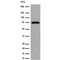 AF6427 at 1/100 staining Mouse colon tissue by IHC-P. The sample was formaldehyde fixed and a heat mediated antigen retrieval step in citrate buffer was performed. The sample was then blocked and incubated with the antibody for 1.5 hours at 22¡ãC. An HRP conjugated goat anti-rabbit antibody was used as the secondary