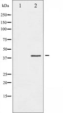 AF6481 staining Hela by IF/ICC. The sample were fixed with PFA and permeabilized in 0.1% Triton X-100,then blocked in 10% serum for 45 minutes at 25¡ãC. The primary antibody was diluted at 1/200 and incubated with the sample for 1 hour at 37¡ãC. An  Alexa Fluor 594 conjugated goat anti-rabbit IgG (H+L) Ab, diluted at 1/600, was used as the secondary antibod