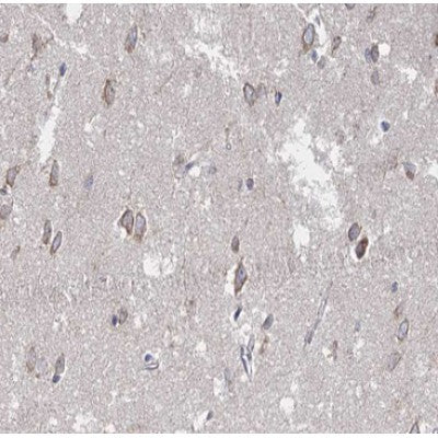 AF0280 at 1/100 staining human brain tissue sections by IHC-P. The tissue was formaldehyde fixed and a heat mediated antigen retrieval step in citrate buffer was performed. The tissue was then blocked and incubated with the antibody for 1.5 hours at 22¡ãC. An HRP conjugated goat anti-rabbit antibody was used as the secondary