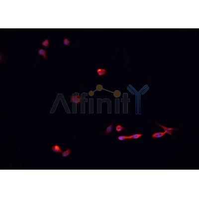 AF0280 staining HeLa  cells by IF/ICC. The sample were fixed with PFA and permeabilized in 0.1% Triton X-100,then blocked in 10% serum for 45 minutes at 25¡ãC. The primary antibody was diluted at 1/200 and incubated with the sample for 1 hour at 37¡ãC. An  Alexa Fluor 594 conjugated goat anti-rabbit IgG (H+L) antibody(Cat.