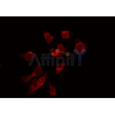AF0280 staining 293 by IF/ICC. The sample were fixed with PFA and permeabilized in 0.1% Triton X-100,then blocked in 10% serum for 45 minutes at 25¡ãC. The primary antibody was diluted at 1/200 and incubated with the sample for 1 hour at 37¡ãC. An  Alexa Fluor 594 conjugated goat anti-rabbit IgG (H+L) Ab, diluted at 1/600, was used as the secondary antibod