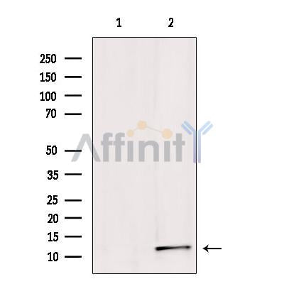 Western blot analysis of extracts from HepG2, using Sumo1 Antibody. Lane 1 was treated with the blocking peptide.