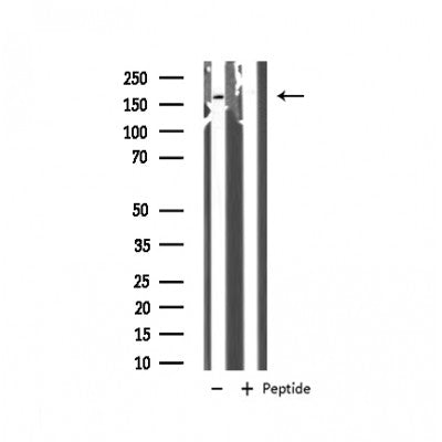 Western blot analysis of extracts from HepG2, using GRF-1 Antibody. Lane 1 was treated with the blocking peptide.