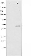 AF6486 staining Hela by IF/ICC. The sample were fixed with PFA and permeabilized in 0.1% Triton X-100,then blocked in 10% serum for 45 minutes at 25¡ãC. The primary antibody was diluted at 1/200 and incubated with the sample for 1 hour at 37¡ãC. An  Alexa Fluor 594 conjugated goat anti-rabbit IgG (H+L) Ab, diluted at 1/600, was used as the secondary antibod