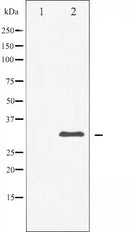 AF6488 at 1/100 staining Rat lung tissue by IHC-P. The sample was formaldehyde fixed and a heat mediated antigen retrieval step in citrate buffer was performed. The sample was then blocked and incubated with the antibody for 1.5 hours at 22¡ãC. An HRP conjugated goat anti-rabbit antibody was used as the secondary