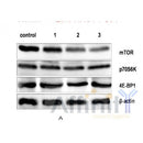 Western blot analysis of extracts from B16F10, using mTOR Antibody. Lane 1 was treated with the blocking peptide.