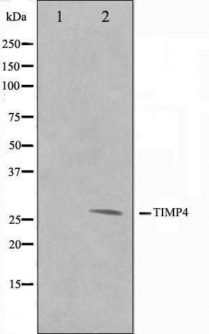 Western blot analysis on NIH-3T3 cell lysate using TIMP4 Antibody,The lane on the left is treated with the antigen-specific peptide.