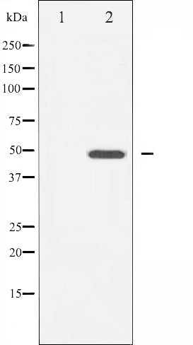 AF6317 staining 293 by IF/ICC. The sample were fixed with PFA and permeabilized in 0.1% Triton X-100,then blocked in 10% serum for 45 minutes at 25¡ãC. The primary antibody was diluted at 1/200 and incubated with the sample for 1 hour at 37¡ãC. An  Alexa Fluor 594 conjugated goat anti-rabbit IgG (H+L) Ab, diluted at 1/600, was used as the secondary antibod